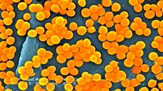 Superbugs on Rise: Global Deaths from Drug-Resistant Infections Projected to Soar by 70% by 2050