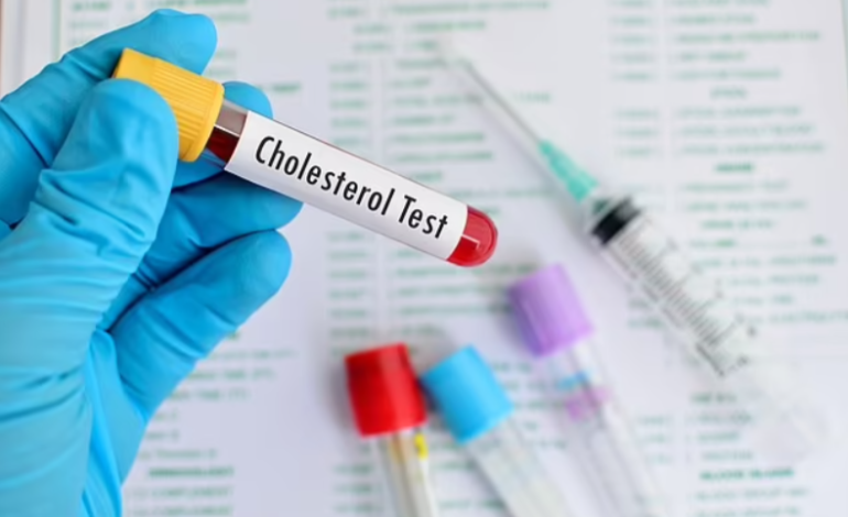 Cholesterol Checks May Help Predict Dementia Risk Years in Advance, Study Suggests