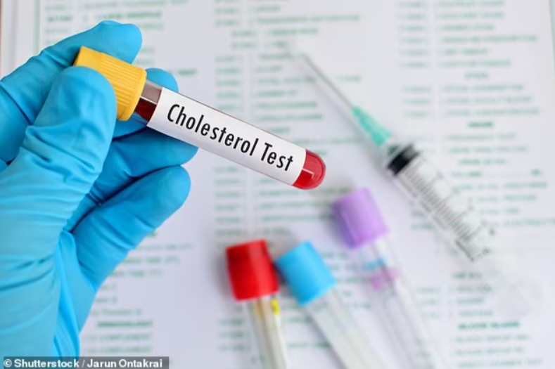 Cholesterol Checks May Help Predict Dementia Risk Years in Advance, Study Suggests