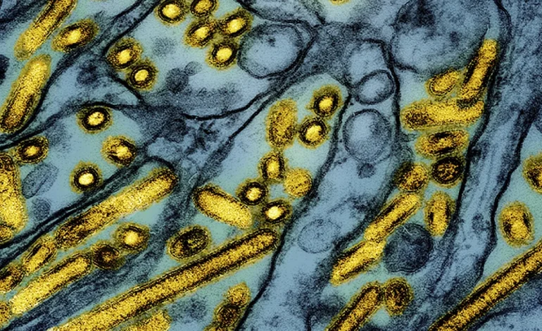 California Reports Suspected Avian Flu Case in Child with Mild Symptoms