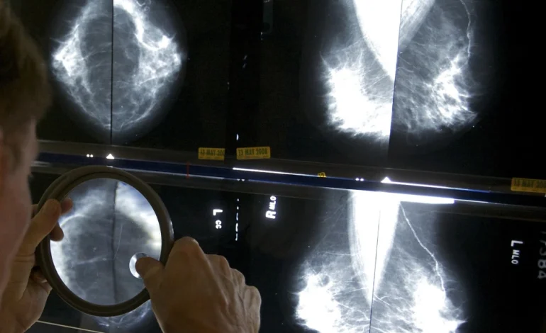 Studies Indicate Some Breast Cancer Patients Can Forego Certain Surgeries