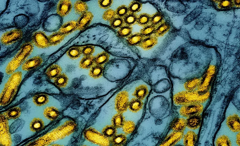 Could Bird Flu Spark the Next Pandemic? Understanding H5N1 After the First US Death