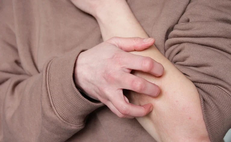 Immune Science Behind the Satisfaction of Scratching