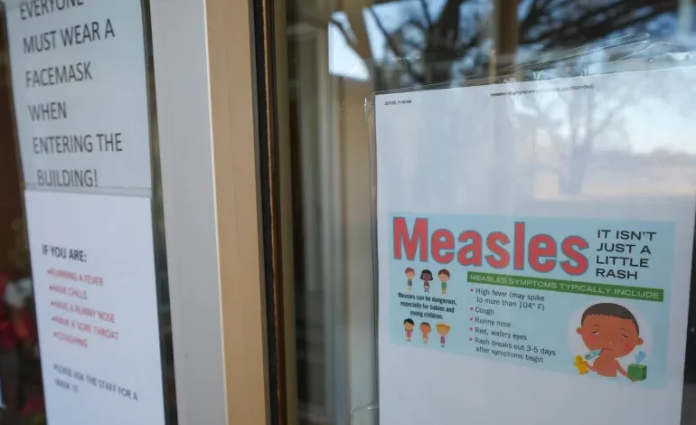 Unvaccinated Child Dies of Measles in Texas, First US Death in Decade