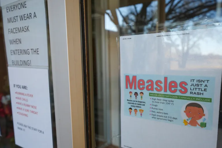 Unvaccinated Child Dies of Measles in Texas, First US Death in Decade