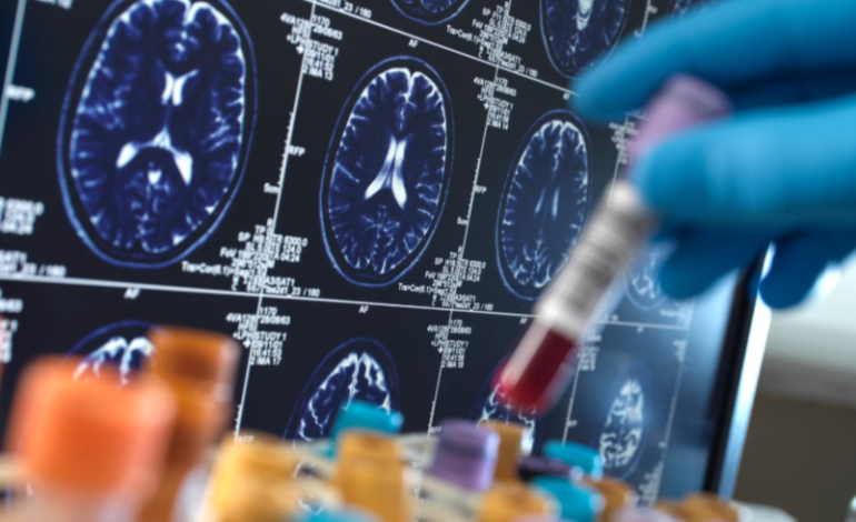 Alzheimer’s Association Urges Early Testing as New Tools Transform Diagnosis and Treatment