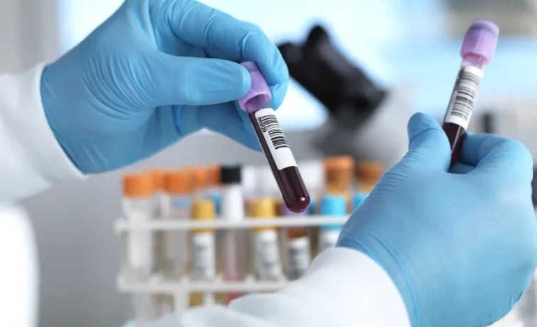 Growing Interest Among Older Americans in Alzheimer’s Testing, Survey Finds