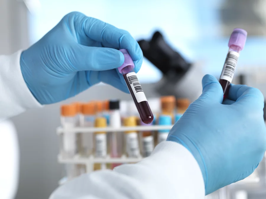 Growing Interest Among Older Americans in Alzheimer’s Testing, Survey Finds