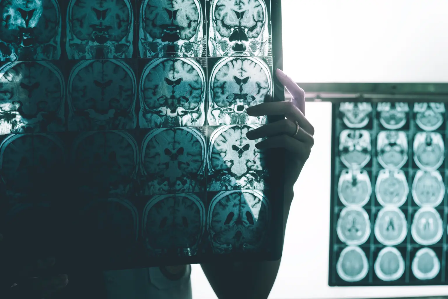 Existing HIV Drugs Show Promise in Reducing Alzheimer’s Risk, Study Finds