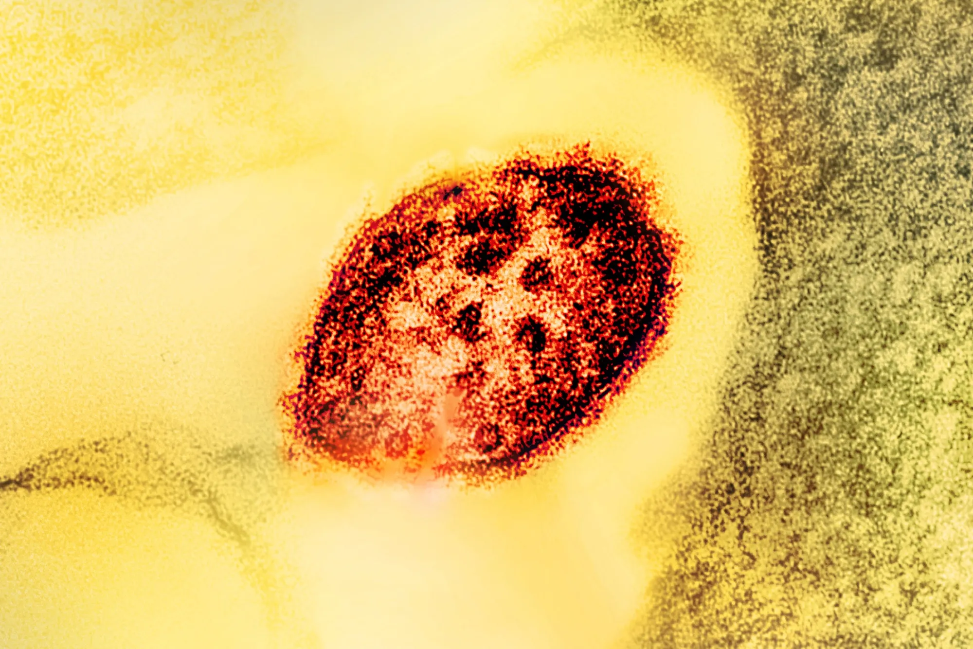 New Initiative Aims to Safeguard US Vaccine Policy Amidst Political Interference, Measles Outbreak
