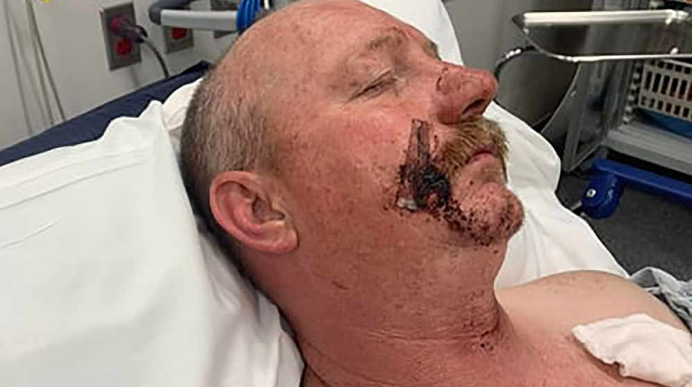 Moorcroft Man Accepts Plea Deal in Aggravated Assault Case Following Domestic Violence Incident