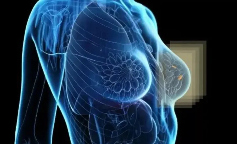 New Imaging Prototype Aims to Improve Breast Cancer Detection in Dense Tissue