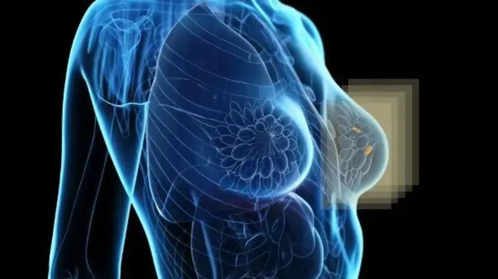 New Imaging Prototype Aims to Improve Breast Cancer Detection in Dense Tissue