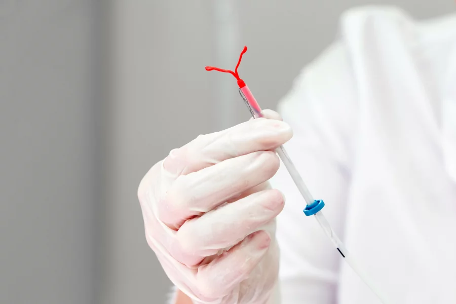 New Guidelines Encourage Better Pain Management for IUD Insertions and Other Gynecological Procedures