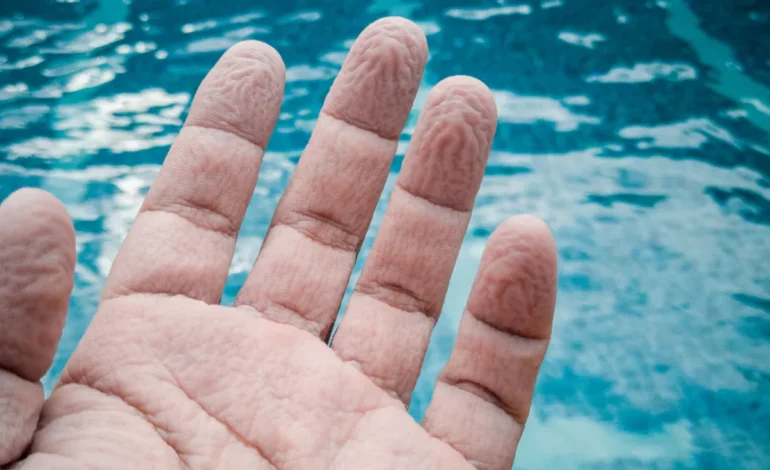 Scientists Uncover the True Cause Behind Water-Induced Finger Wrinkles