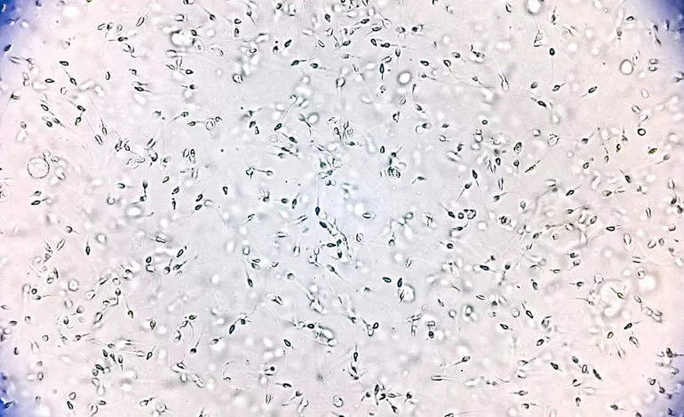 Calls for Stricter Sperm Donation Regulations After Rare Genetic Mutation Linked to Cancer Found in Donor’s Offspring