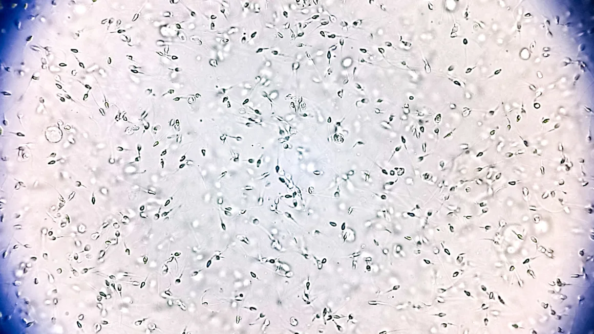 Calls for Stricter Sperm Donation Regulations After Rare Genetic Mutation Linked to Cancer Found in Donor’s Offspring