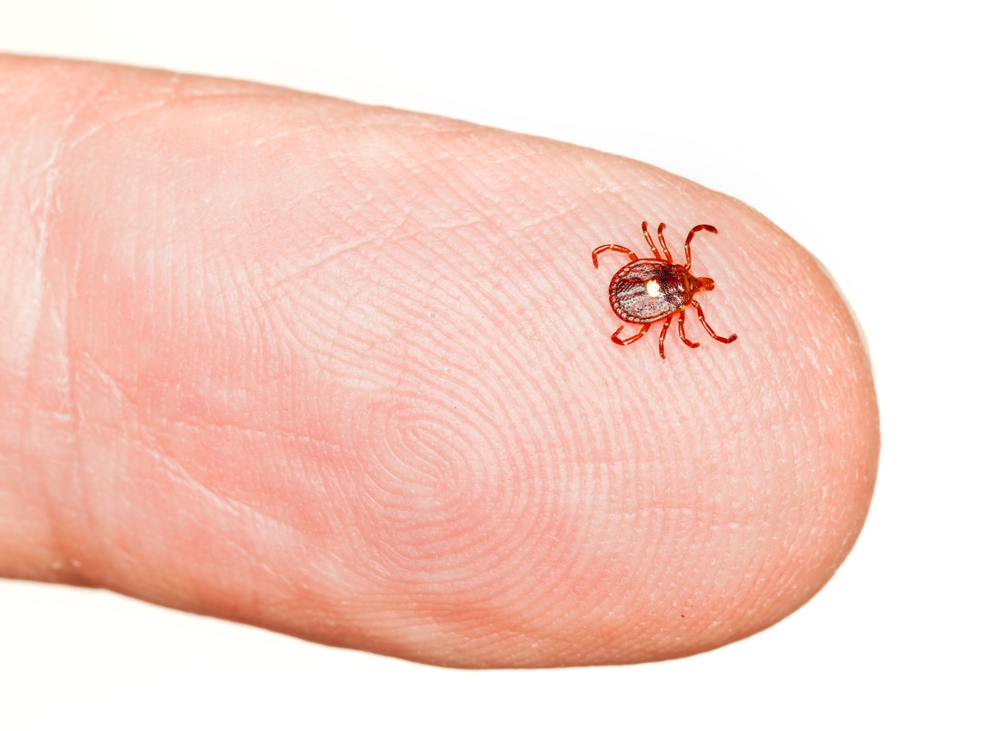 Tick Bite Prevention: How to Stay Safe Outdoors This Summer