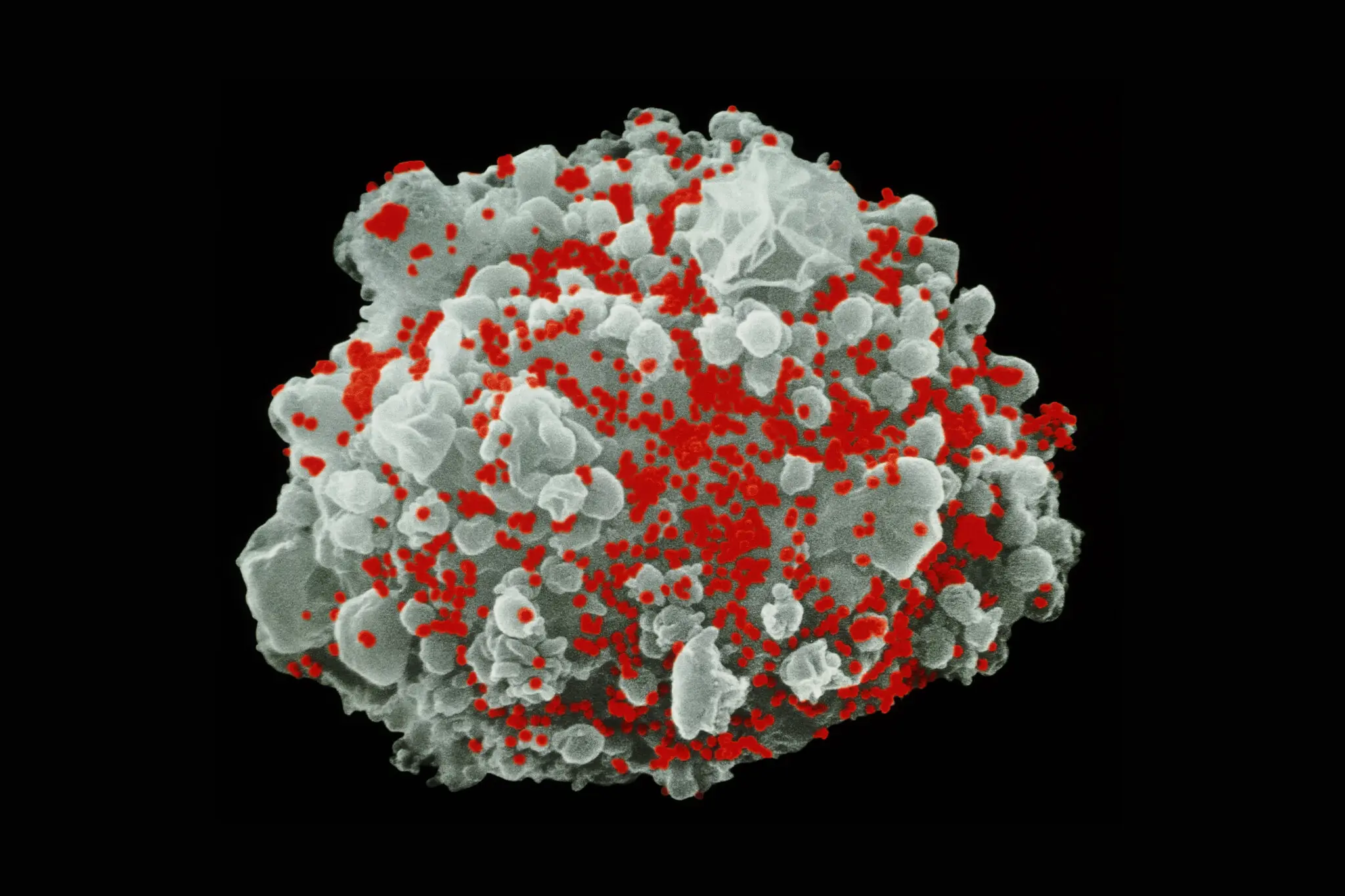 New Technique Sheds Light on Hidden HIV, Offering Hope for Future Treatments