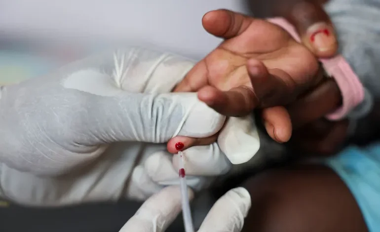 UN Warns Millions Could Die by 2029 if US HIV Funding Isn’t Replaced