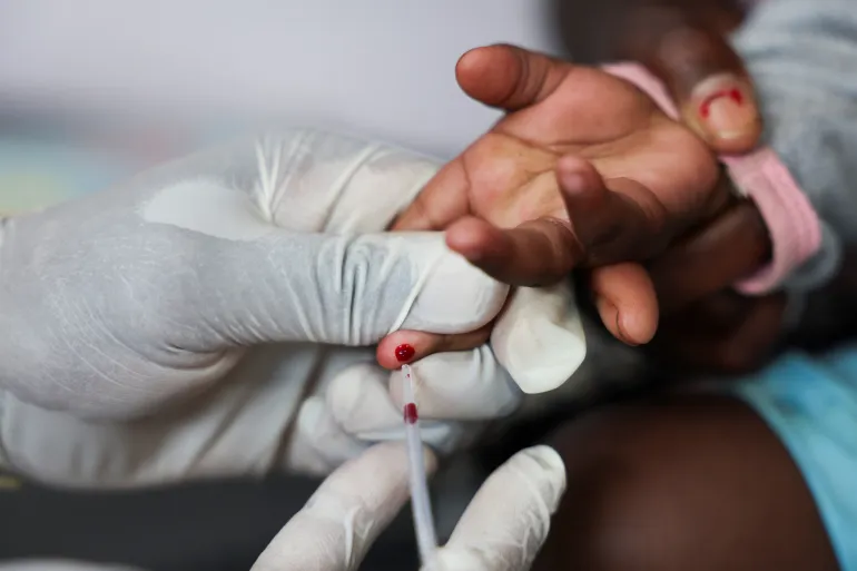 UN Warns Millions Could Die by 2029 if US HIV Funding Isn’t Replaced