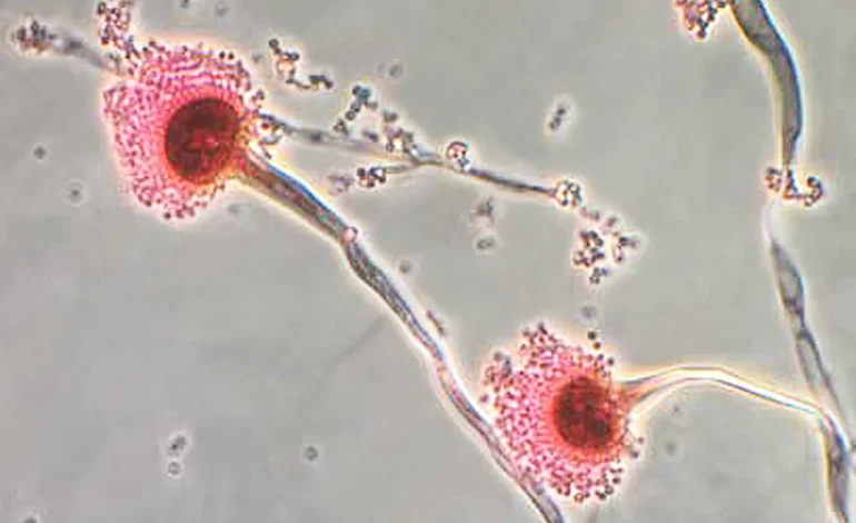 Rising Resistance in Fungal Infections Sparks Growing Concern Among Scientists