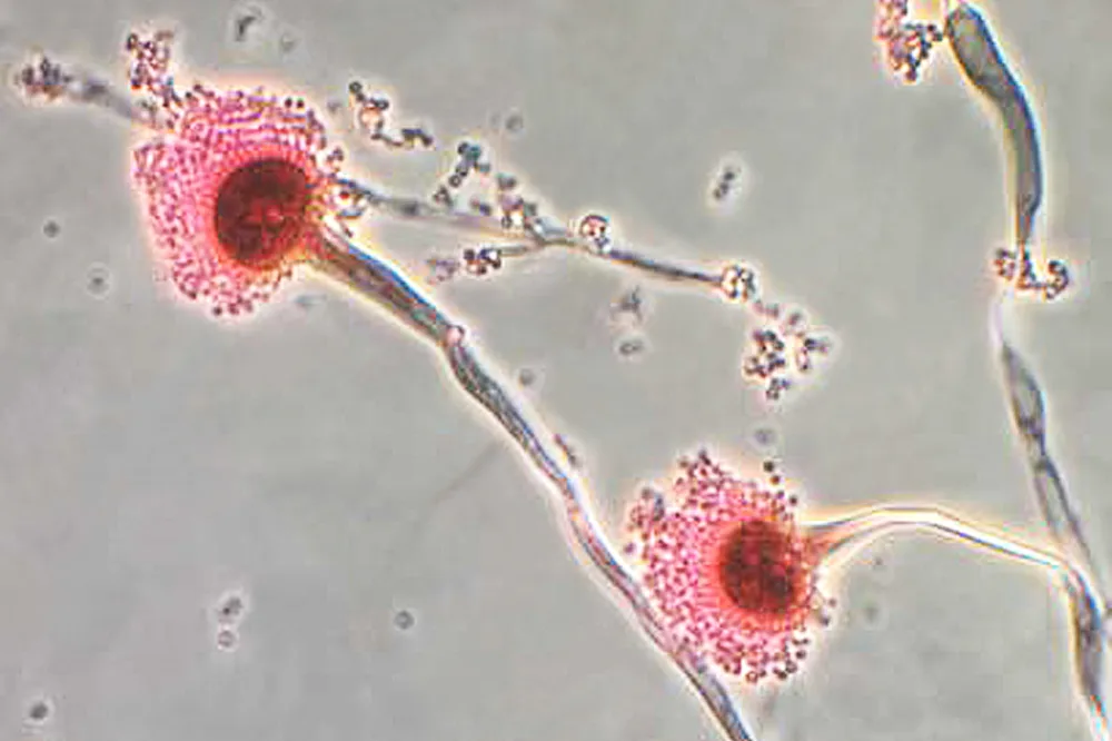 Rising Resistance in Fungal Infections Sparks Growing Concern Among Scientists