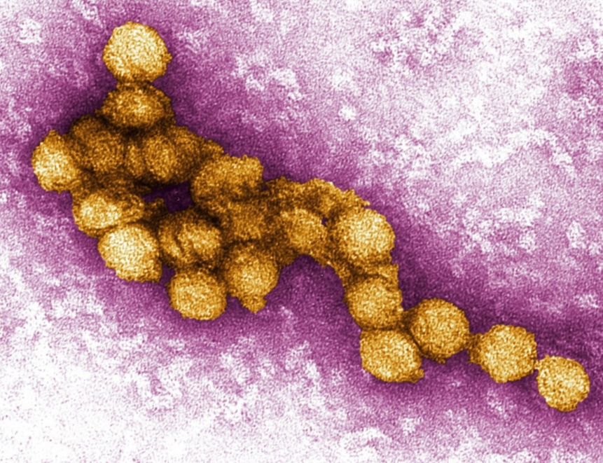 First Case of West Nile in Wyoming Horse This Year Puts Owners on Alert