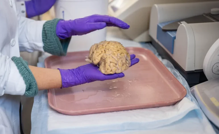 Meet the SuperAgers: The 80-Somethings with Brains as Sharp as 50-Year-Olds