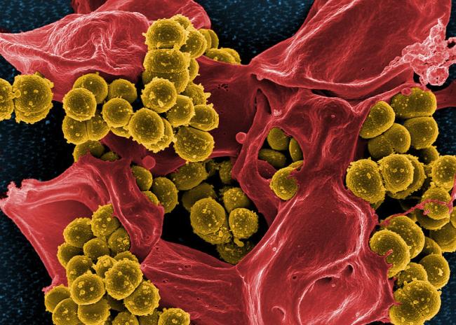 Two Shots, Seven Days Apart: New Staph Treatment Could Replace Weeks of Daily IVs